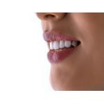 Чи варто знімати зубний наліт ультразвуком